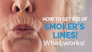 How to remove smokers lines update [upl. by Naitsabes]