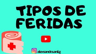 Tipos de Ferida  Vídeo Aula 2021 [upl. by Aiyot]