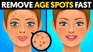 The quickest way to remove age spots [upl. by Noonan]