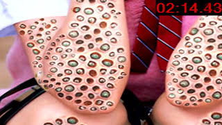 Do YOU Have Trypophobia [upl. by Ariaet871]