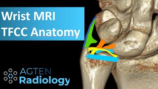 MRI Anatomy of TFCC [upl. by Romina]