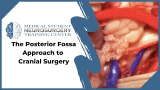 The Posterior Fossa Approach to Cranial Surgery [upl. by Evadnee]