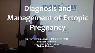 RCOG Guidelines Diagnosis and Managment of Ectopic Pregnancy [upl. by Tiffy]