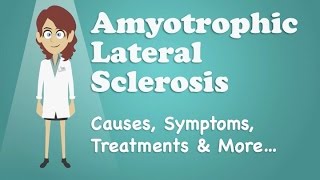 Amyotrophic Lateral Sclerosis ALS  CRASH Medical Review Series [upl. by Nrev]