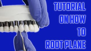 Dental Root Planing 101  StepbyStep [upl. by Clotilda]