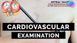 Cardiovascular Examination  OSCE Guide  UKMLA  CPSA  PLAB 2 [upl. by Kcinemod323]