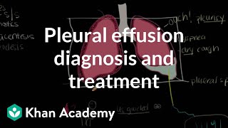 Pleural effusion diagnosis and treatment  Respiratory system diseases  NCLEXRN  Khan Academy [upl. by Jeni]