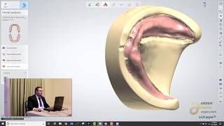 Digital Dentures A Crash Course on How to Design using 3Shape  Logan Woomer [upl. by Strong]