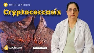 Cryptococcosis  Infectious Medicine Video Lectures  Medical Education  VLearning [upl. by Eilrak853]