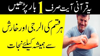 Best wazifa for itchy skin treatment  kharish ka ilaj in urdu how to stop skin itching [upl. by Glenn]