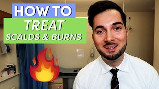 Burns  How To Treat Burns  How To Treat A Burn [upl. by Naehs]