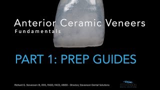 Anterior Ceramic Veneers Part 1 Preparation Guides [upl. by Eenad]