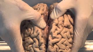 Introduction Neuroanatomy Video Lab  Brain Dissections [upl. by Ylrac761]