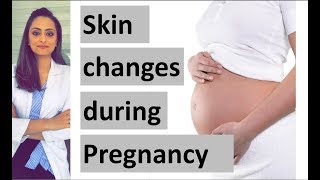 Skin changes in pregnancy  Dermatologist  Dr Aanchal Panth [upl. by Josh]