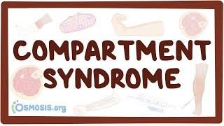 ABDOMINAL COMPARTMENT SYNDROME  Causes Types Clinical Features Management [upl. by Eggett]