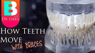 BRACES EXPLAINED How Teeth Move  Braces Work [upl. by Adabel]