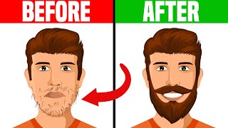 How to Deal With a Patchy Beard [upl. by Anaeli933]