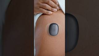 Eversense Sensor Revolutionizing Diabetes Monitoring [upl. by Nosredneh782]