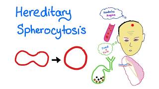 Hereditary Spherocytosis HS  Red Blood Cell Disorders  Hematology [upl. by Anirat]