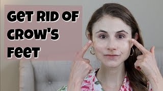 HOW TO GET RID OF CROWS FEET DR DRAY [upl. by Linders]