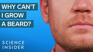 Why Some Men Cant Grow Beards [upl. by Erme]