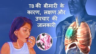 Tuberculosis TB के कारण लक्षण और उपचार – Tuberculosis Causes Symptoms amp Treatment in Hindi [upl. by Ellerey]