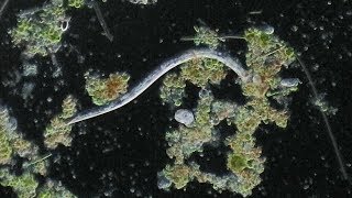 Nematodes Under Microscope [upl. by Marquet]