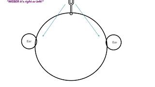 Weber vs Rinne Test amp Conductive vs Sensorineural Hearing Loss [upl. by Malda]