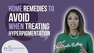 How to Treat Hyperpigmentation  Home Remedies  DO THEY WORK [upl. by Latsyrk]