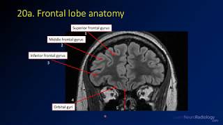 Neuroradiology review  brain gyral anatomy [upl. by Ransell]