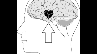 ¿Como desenamorarse de cualquier persona La ciencia del desamor comprobada [upl. by Aniratak]