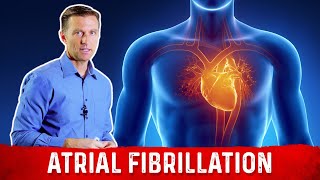 Atrial Fibrillation Overview  ECG types pathophysiology treatment complications [upl. by Aynam]