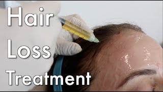 Hair Loss Treatment PRP [upl. by Enilra394]