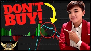 Learn MACD in 30 Minutes  ALL The Basics You Need [upl. by Noirrad]