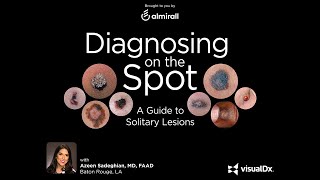 Diagnosing on the Spot A Guide to Solitary Lesions [upl. by Ennyrb31]