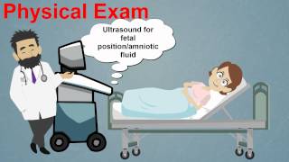 Topic 25 Premature Rupture of Membranes [upl. by Mikkel844]