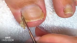 How Toenails Are Professionally Cleaned [upl. by Rivi106]