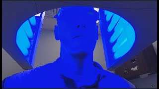 PHOTODYNAMIC THERAPY ”BLUE LIGHT” Im getting my face burned off [upl. by Bland]