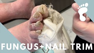 CRAZY THICK NAIL TRIM  FUNGUS [upl. by Johathan319]