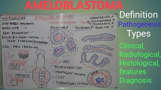 Ameloblastoma  Definition pathogenesis types clinical radiological features and diagnosis [upl. by Linea]