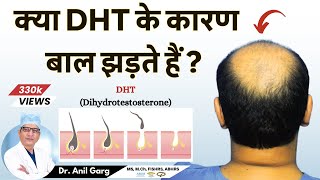 क्या DHT के कारण बाल झड़ते हैं  Do DHT Causes Hair Loss  Dr Anil Garg [upl. by Bywoods153]