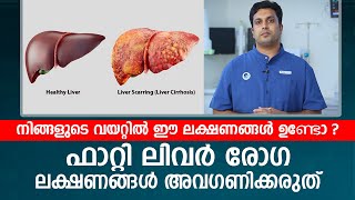 നിങ്ങളുടെ വയറ്റിൽ ഈ ലക്ഷണങ്ങൾ ഉണ്ടോ  Fatty Liver രോഗ ലക്ഷണങ്ങൾ അവഗണിക്കരുത് [upl. by Rodmann]