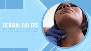 Getting Lip Fillers for the First Time 🧪 Everything You Need to Know about Lip Fillers [upl. by Riehl]