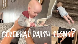 Does He Have Cerebral Palsy Hypertonia  Sagittal Craniosynostosis issues [upl. by Ramedlab845]