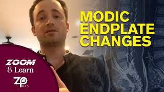 Modic Endplate Changes  Zoom amp Learn [upl. by Llennaj]