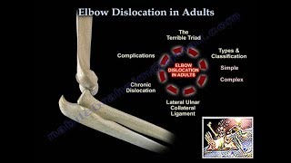 Elbow Dislocation In Adults  Everything You Need To Know  Dr Nabil Ebraheim [upl. by Alyahsat]