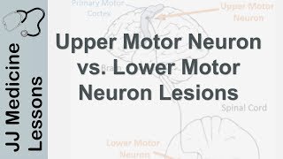 Rh incompatibility and Hemolytic disease of the newborn HDN [upl. by Onaled]