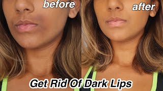 How To Get rid Of Dark Lips And Pigmentation [upl. by Sewell988]