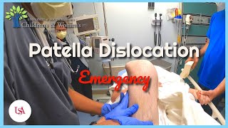 Patella Dislocation Emergency [upl. by Eiten]