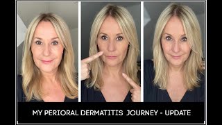 What Casues Perioral Dermatitis [upl. by Anerehs534]